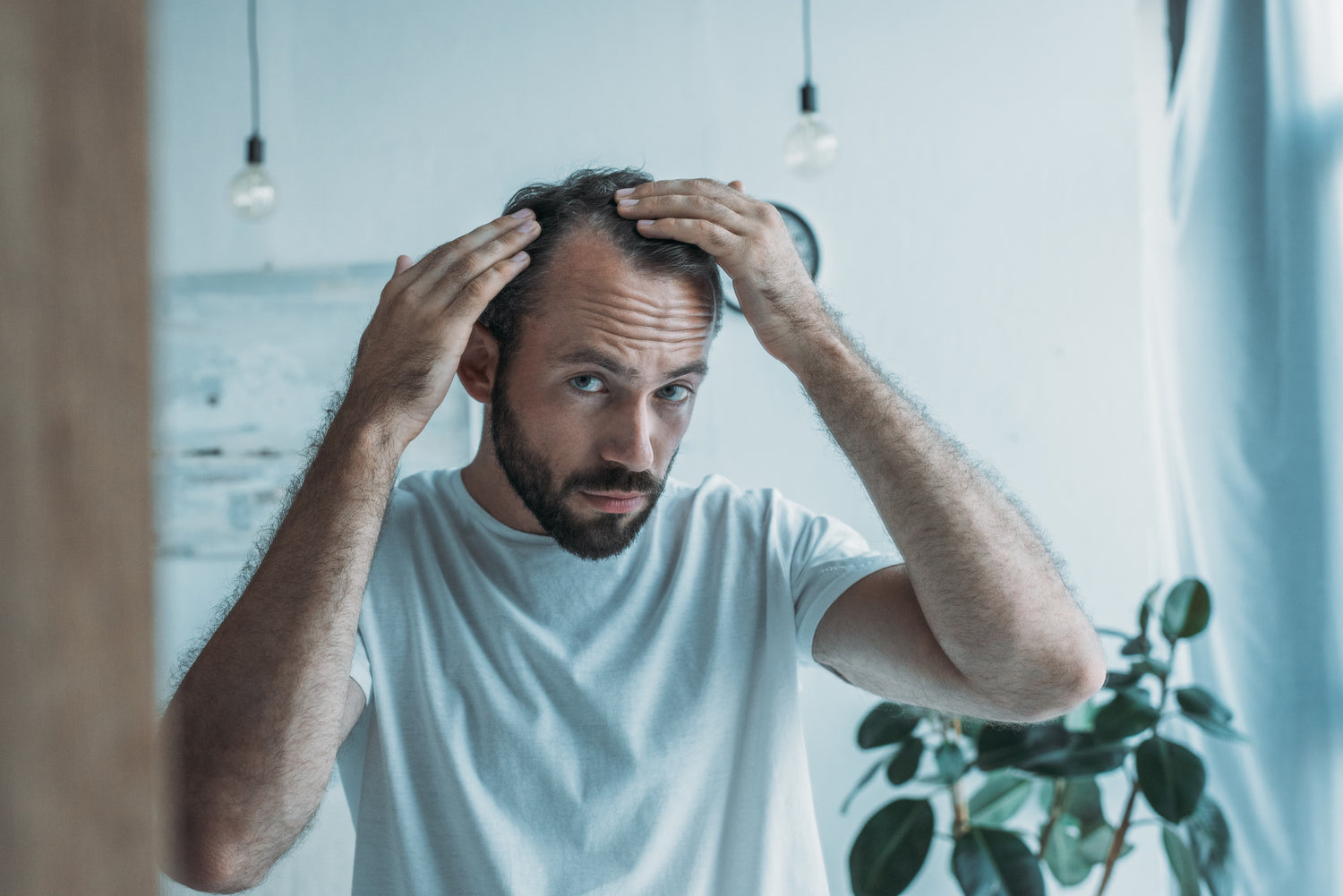 Man with thinning hair