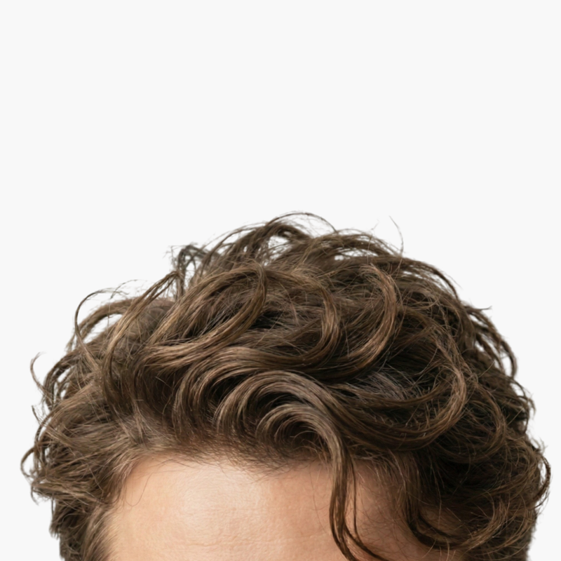 Close-up of healthy male hairline showing thicker, fuller hair growth after using Deoxylocks 5% 2DDR Hydrogel.